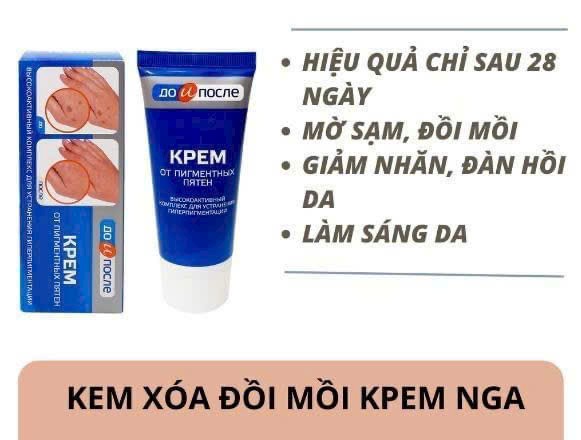 Kem loại bỏ đồi môi tay chân KPEM Nga 50ml